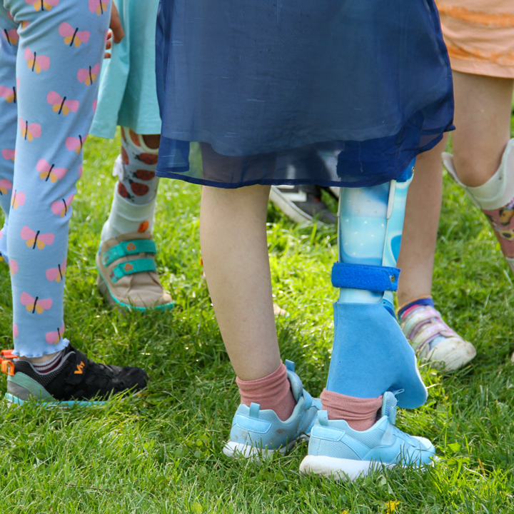 Hüftabwärts aufgenommenes Foto einer Gruppe bunt gekleideter Kinder mit farbigen Bein- und Knie-Prothesen, die auf Rasen stehen